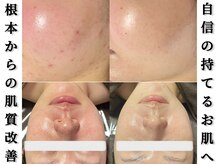 クッカ(kukka)の雰囲気（フェイシャルメニューにも力を入れてます！どんな肌悩みも改善☆）