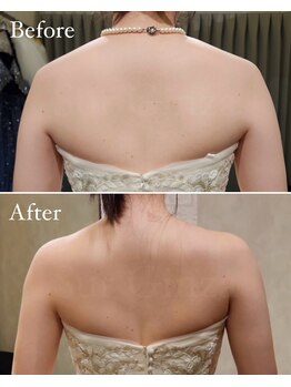 エステサロン シュール/オーダーメイド1ヶ月(4回)