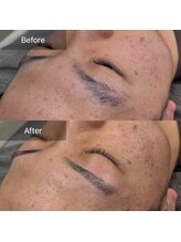 ニューミー(NEW ME)/加古川メンズ眉毛/眉毛デザイン