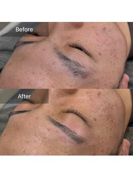 ニューミー(NEW ME)/加古川メンズ眉毛/眉毛デザイン