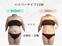 ウェリナ平和堂長久手院/小顔矯正/骨盤矯正/痩身/整体