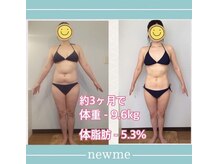 ニュウミー 諏訪本店(newme)/お客様ビフォーアフター