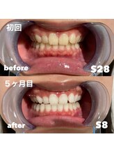 リノア サロン(Lino'a Salon)/Before&After１