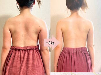 つばききよら/－8キロで背中美人に♪
