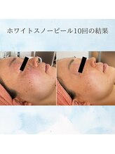 マリー エクラン/