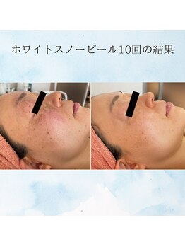 マリー エクラン/