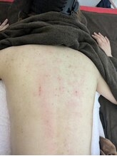 リデザイン 京都(REDESIGN)/REDESIGN京都中医施術法