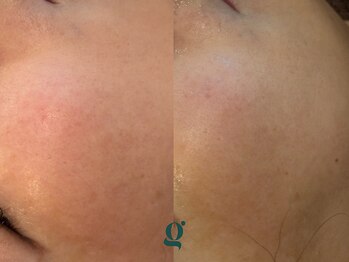 グレイスリリー(grace lily)/