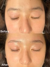 パピヨン(papillon)/ハリウッドブロウリフト【HBL】