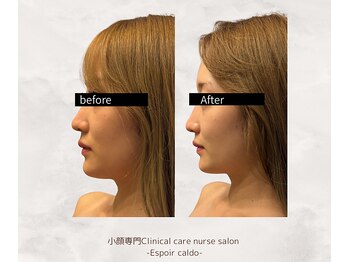 エスポワールカルド(Espoir caldo)/