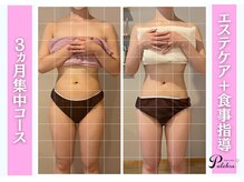 プルクレ 常磐町店(Pulchre)/お腹、太ももが気になる方にも♪