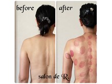 サロン ド アール(salon de R.)の雰囲気（無意識が積み重なりお悩みに‥骨から立て直し美姿勢＆美ボディへ）