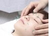 40代からのVie(美）容鍼　ベーシックコース　通常6,600円⇒初回限定4,980円