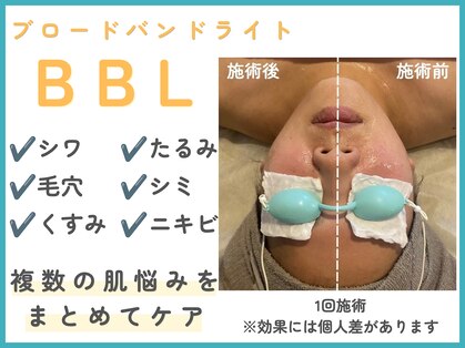 トッコ 那須塩原店(tocco)の写真