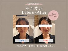 ヨサパーク アーフ(YOSA PARK af.)の雰囲気（【30代-4キロ】ダイエット、全身美肌、保湿効果の底上げも◎）
