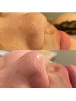 ベリーベリー 九条店(VERY-VERY)/