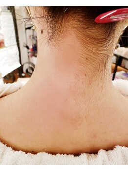 プトゥリ(Putri)/施術前と後の半分半分