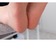 エムネイル(M.Nails)の雰囲気（お足元もふっくらつやつやに。ウオノメやタコもご相談下さい。）