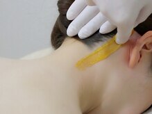 ライズ 札幌店(RISE)/うなじのダブル脱毛