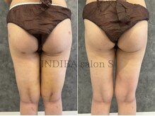 インディバ サロン S/お客様 Before→After