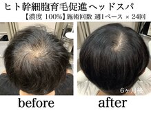 アンス(anth:)の雰囲気（定期的な【ヒト幹細胞ヘッドスパ】施術で効果を実感して頂けます）