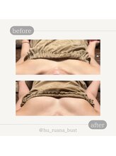 フルアナ(Hu ruana)/姿勢・巻き肩改善・バストケア