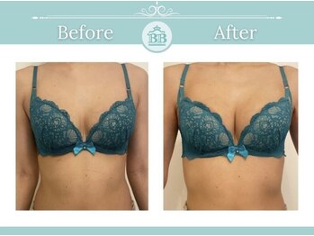 美人バスト 掛川店/【バストアップ/育乳静岡/掛川】