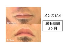 メンズビオ 神戸三宮店/