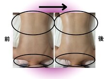 カリアンヌ/温活リンパマッサージ/肩こり