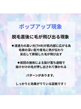 ココプラス(COCO+)/ポップアップ現象