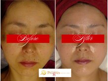 エステティックルームプログレス(Esthetic Room Progres)の雰囲気（当サロンでは、良質なヒト幹細胞培養液を多種取り扱っています）