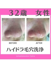 ピアリーノ(Pialino)/