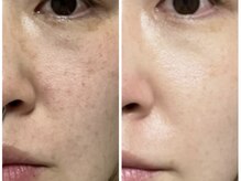 エビスラボ(Ebisu Labo)の雰囲気（美顔器でしっかり細胞動かしてお顔のトーンアップ！艶肌/くすみ）