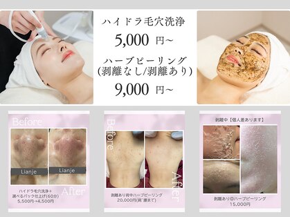 リアンジェ(Lianje)の写真