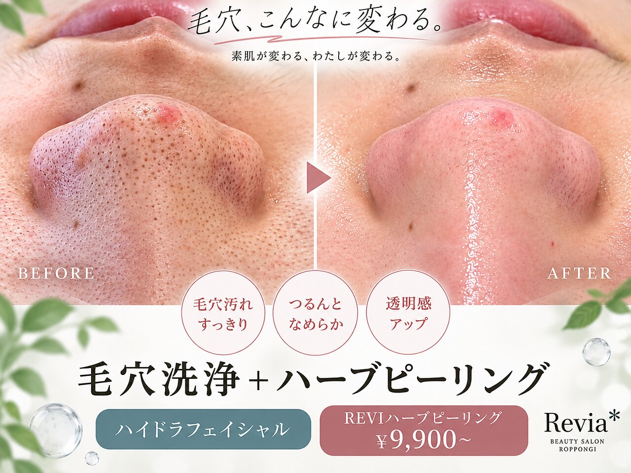 REVI ハーブピーリング 効果 なしに関するエステサロン 【韓国肌専門店