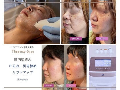 泡のきもちの写真