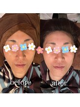 ウナ デ リンゴル 恵比寿店(UNA de Ringol)/サークールで透明感溢れる肌へ