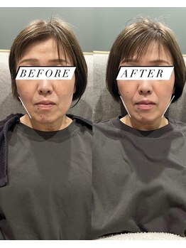 シロ(silo.)/ヒーリングケアクーポン