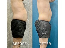 ブランシュムーニー(BRANCHE MOONY)/ご来店から4ヶ月で別人に