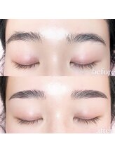 リア(lia)/アイブロウリフト