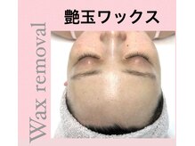 ヴィアージュ/顔ワックス脱毛でツヤツヤ