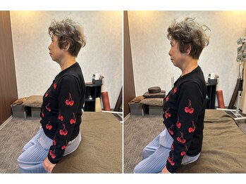 サロン ド ツリーズ(Salon de Trees)/反り腰矯正2