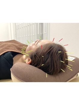 眼精疲労を解消したい