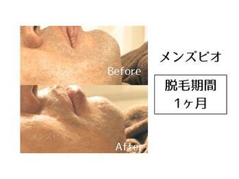 メンズビオ 神戸三宮店/