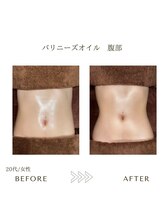 サロンエイトミー 西船橋店(salon 83)/バリニーズオイル/before→after