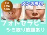 【シミケア・くすみ・毛穴引き締め】　IPL光フェイシャル