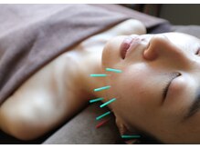 やなけん 亀戸店/エラ張り/食いしばり/美容鍼灸