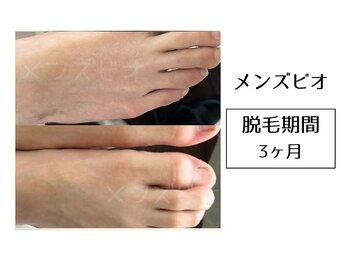 メンズビオ 神戸三宮店/