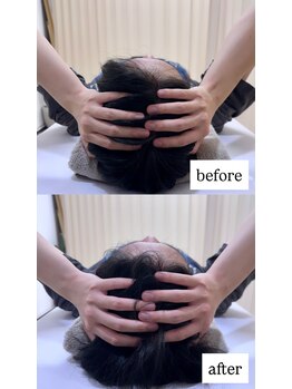 ルーツ 渋谷店(R∞ts)/頭蓋矯正【渋谷/小顔矯正/整体】