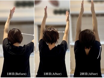 ジェイミープラス 表参道(J‘aimee +)/肩の痛みビフォーアフター